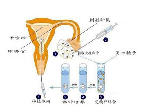 北京供卵试管孩子，生育梦想的实现路径