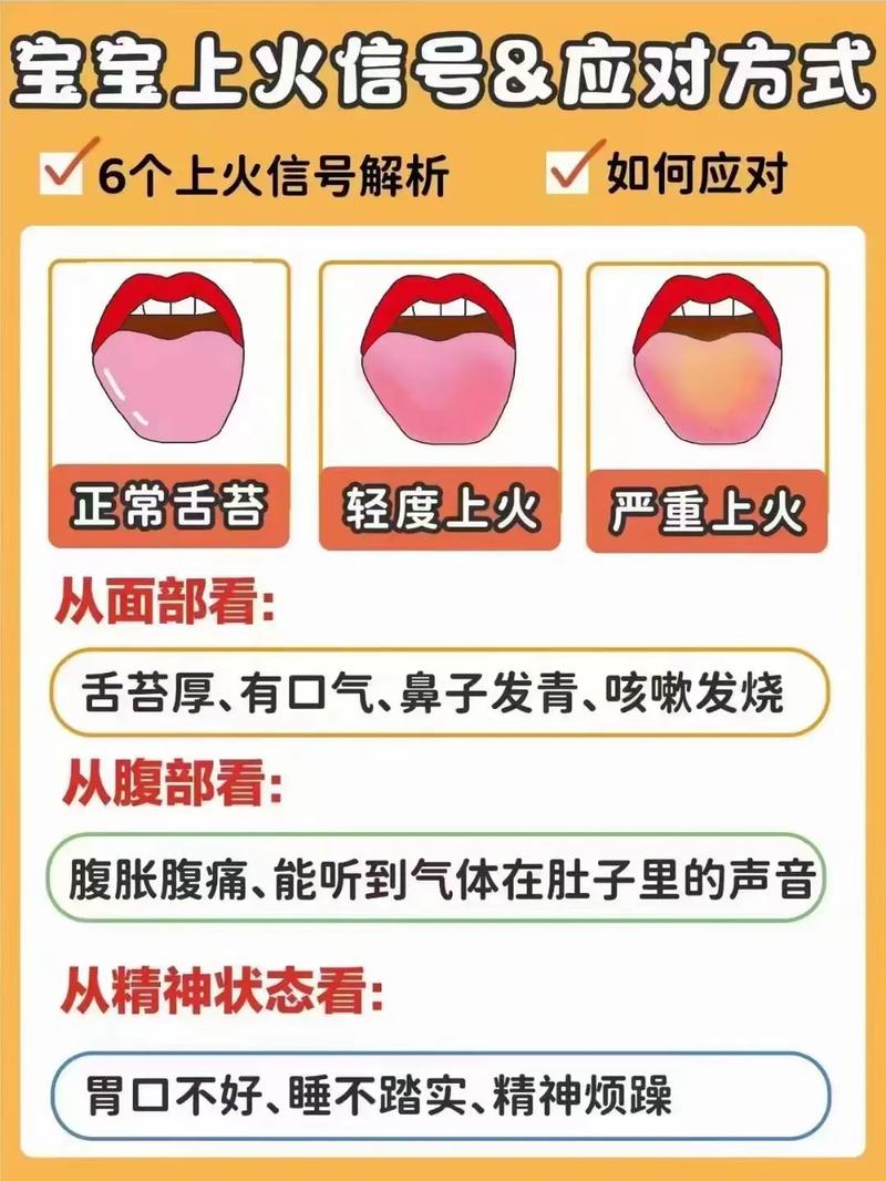 二个月宝宝上火怎么办
