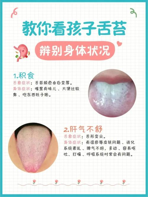 两个月宝宝舌苔厚怎么办