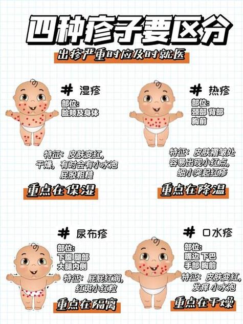 一岁多的宝宝湿疹怎么办