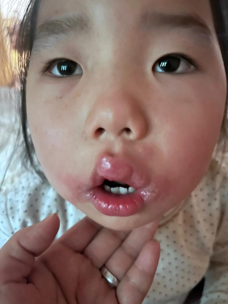 宝宝嘬嘴唇是怎么回事