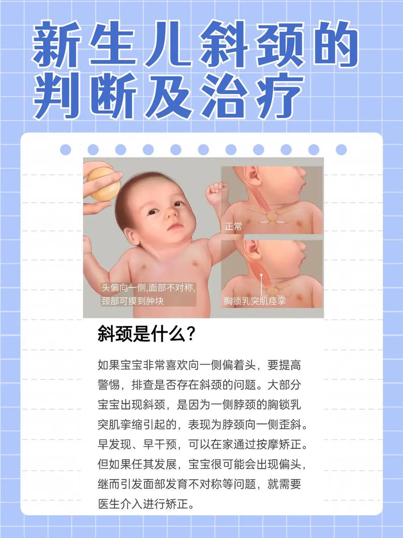 5个月宝宝斜颈怎么办
